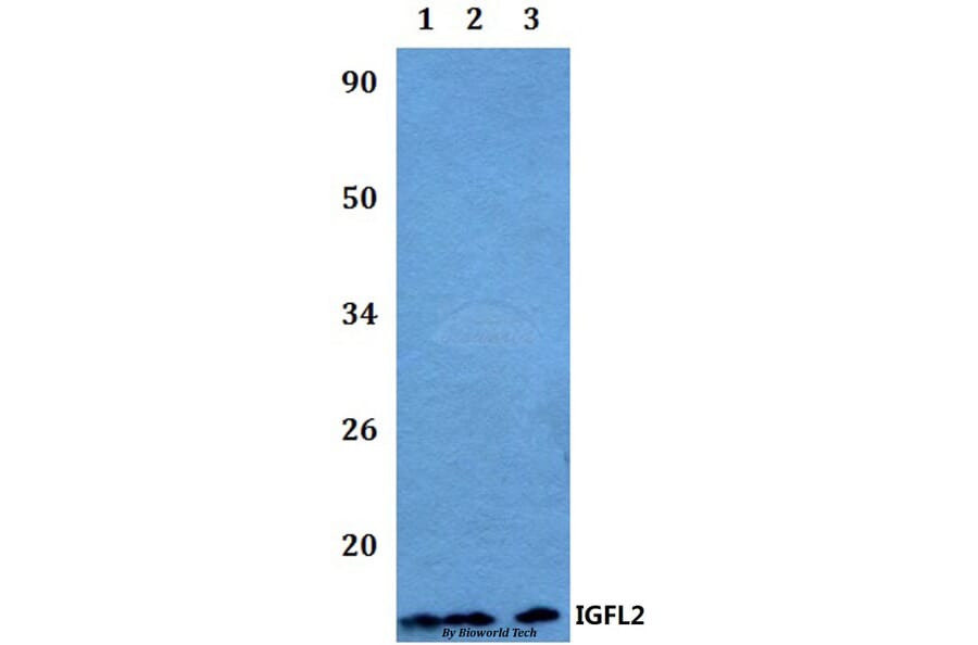Anti-IGFL2 Antibody from Bioworld Technology (BS60493) - Antibodies.com