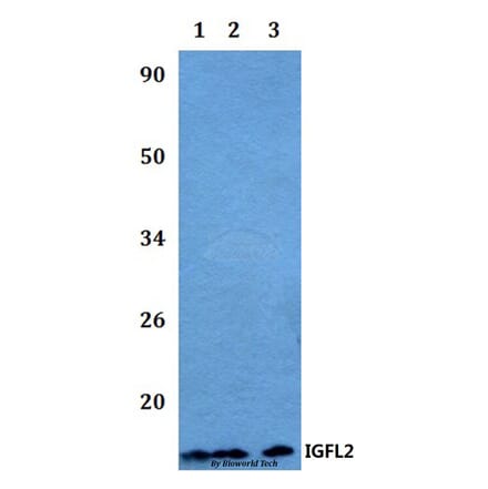 Anti-IGFL2 Antibody from Bioworld Technology (BS60493) - Antibodies.com
