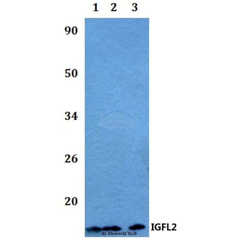 Anti-IGFL2 Antibody from Bioworld Technology (BS60493) - Antibodies.com