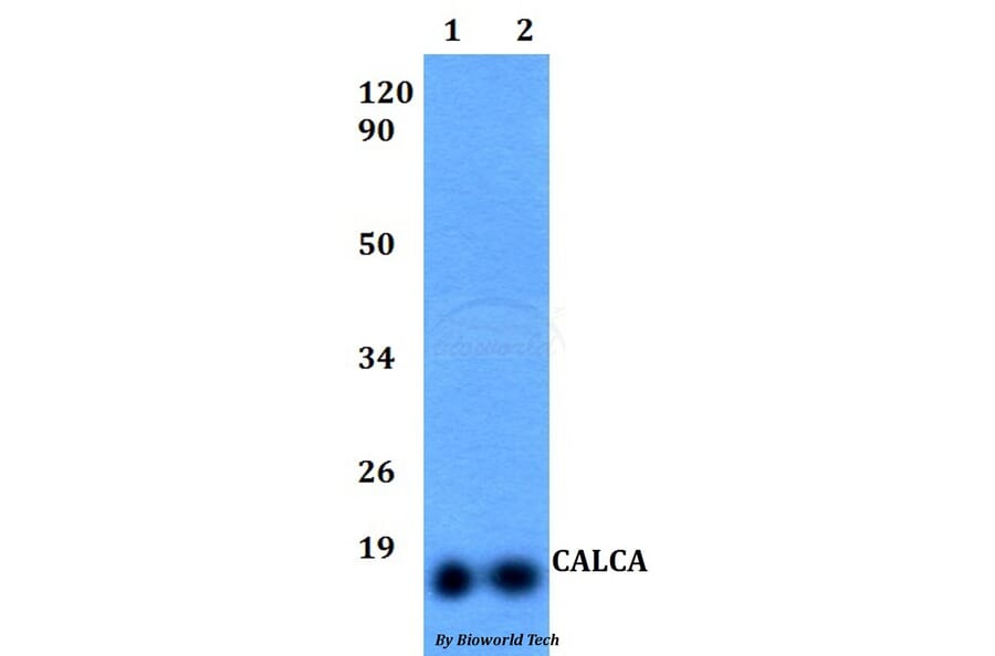 Anti-CALCA Antibody from Bioworld Technology (BS60494) - Antibodies.com