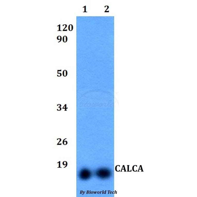 Anti-CALCA Antibody from Bioworld Technology (BS60494) - Antibodies.com