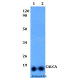 Anti-CALCA Antibody from Bioworld Technology (BS60494) - Antibodies.com
