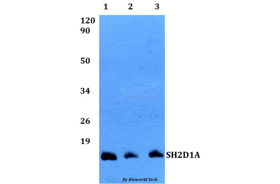 Anti-SH2D1A Antibody from Bioworld Technology (BS60496) - Antibodies.com