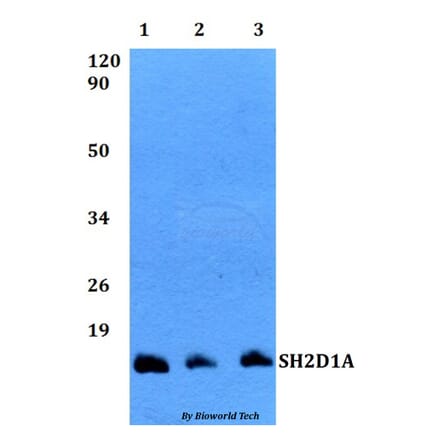 Anti-SH2D1A Antibody from Bioworld Technology (BS60496) - Antibodies.com