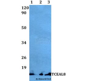 Anti-TCEAL8 Antibody from Bioworld Technology (BS60497) - Antibodies.com
