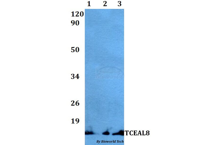Anti-TCEAL8 Antibody from Bioworld Technology (BS60497) - Antibodies.com