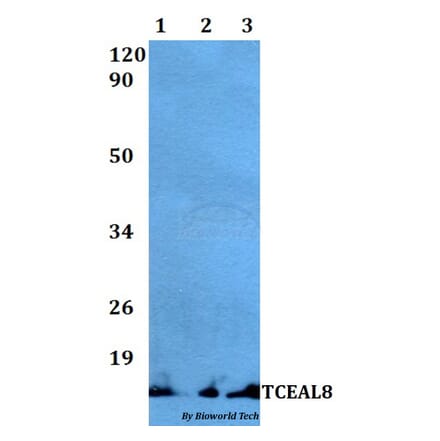 Anti-TCEAL8 Antibody from Bioworld Technology (BS60497) - Antibodies.com