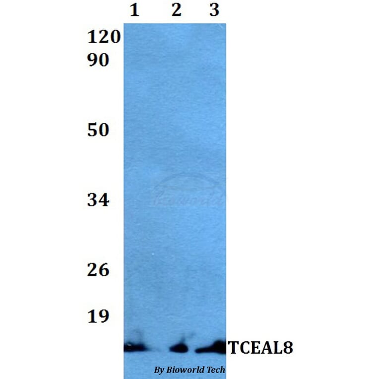 Anti-TCEAL8 Antibody from Bioworld Technology (BS60497) - Antibodies.com