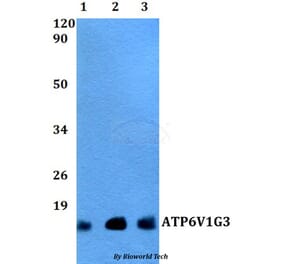 Anti-ATP6V1G3 Antibody from Bioworld Technology (BS60498) - Antibodies.com