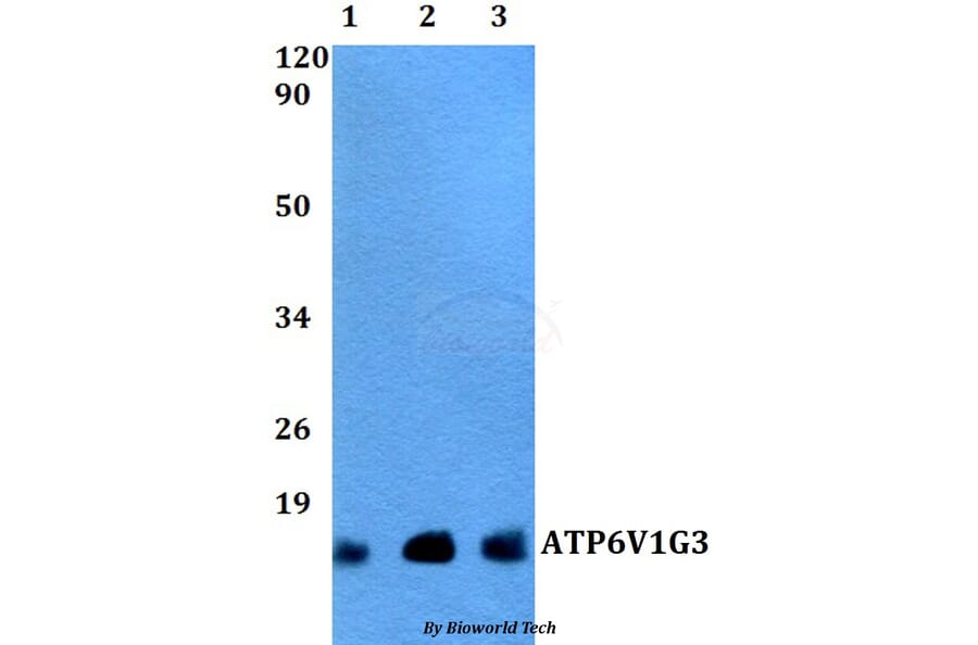 Anti-ATP6V1G3 Antibody from Bioworld Technology (BS60498) - Antibodies.com