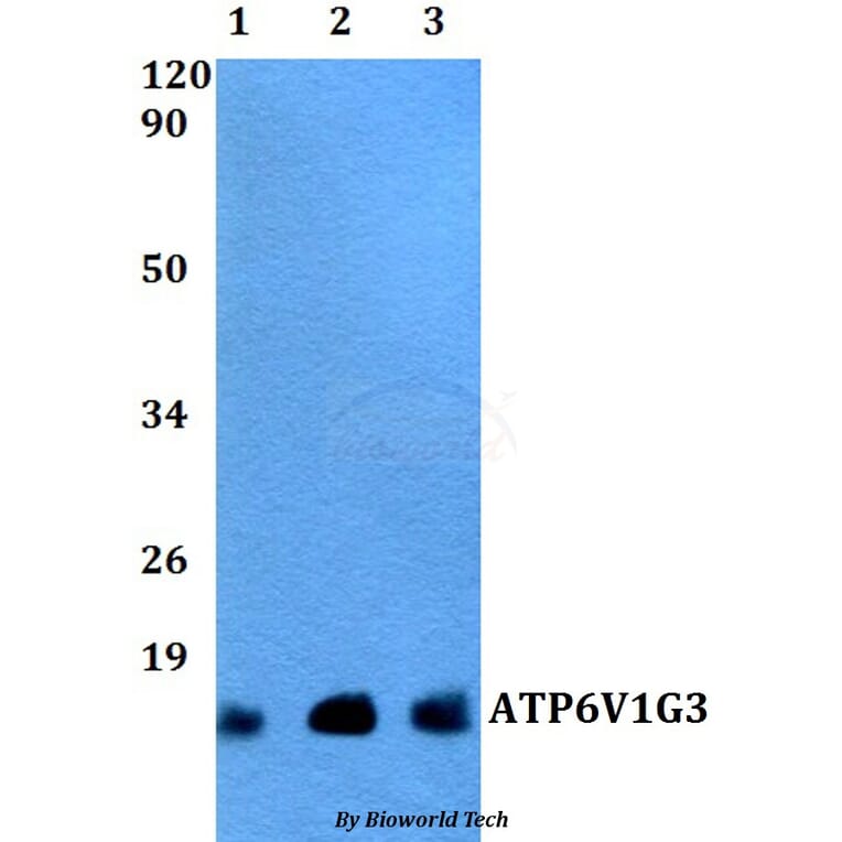 Anti-ATP6V1G3 Antibody from Bioworld Technology (BS60498) - Antibodies.com