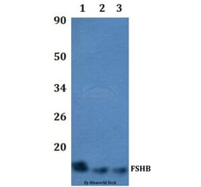 Anti-FSHB Antibody from Bioworld Technology (BS60499) - Antibodies.com