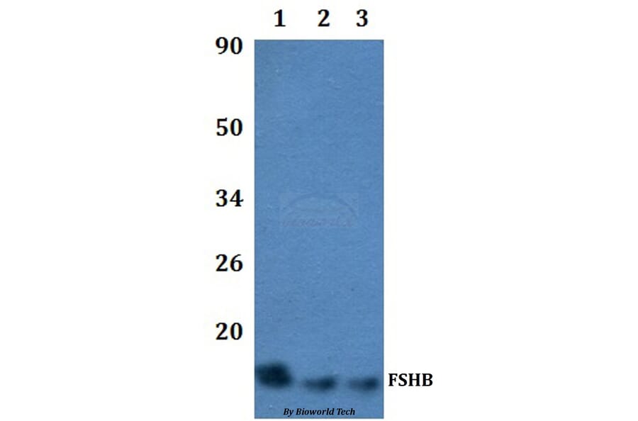 Anti-FSHB Antibody from Bioworld Technology (BS60499) - Antibodies.com