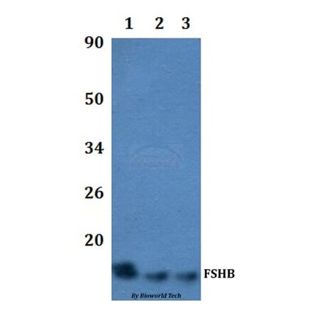 Anti-FSHB Antibody from Bioworld Technology (BS60499) - Antibodies.com
