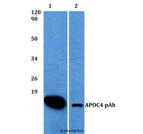 Anti-APOC4 Antibody from Bioworld Technology (BS60500) - Antibodies.com