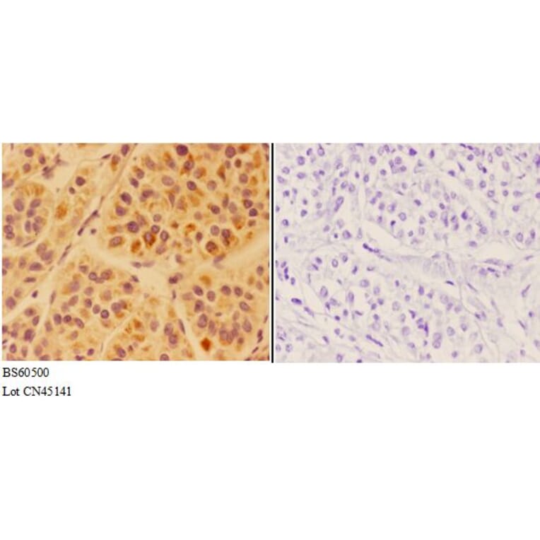 Anti-APOC4 Antibody from Bioworld Technology (BS60500) - Antibodies.com
