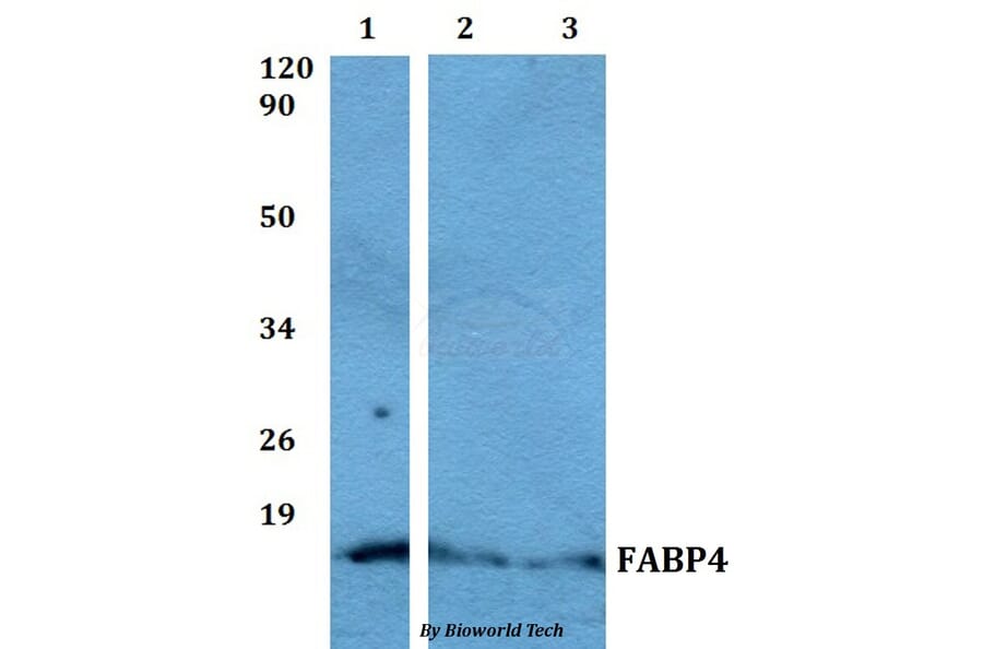 Anti-FABP4 Antibody from Bioworld Technology (BS60504) - Antibodies.com