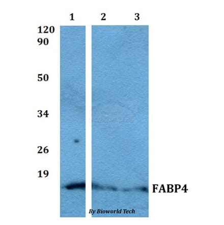 Anti-FABP4 Antibody from Bioworld Technology (BS60504) - Antibodies.com