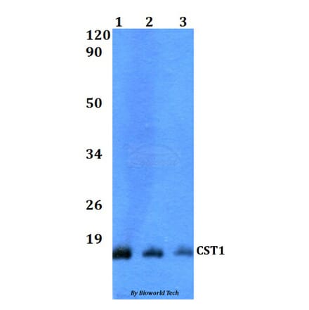 Anti-CST1 Antibody from Bioworld Technology (BS60505) - Antibodies.com