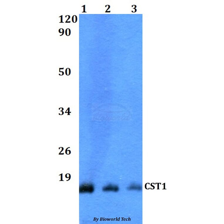 Anti-CST1 Antibody from Bioworld Technology (BS60505) - Antibodies.com