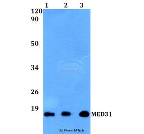 Anti-MED31 Antibody from Bioworld Technology (BS60506) - Antibodies.com