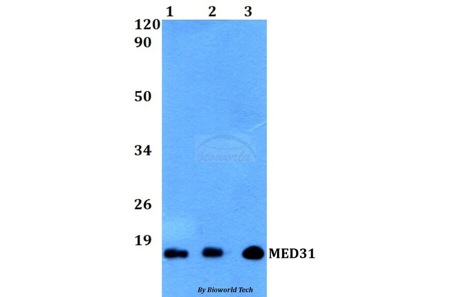 Anti-MED31 Antibody from Bioworld Technology (BS60506) - Antibodies.com