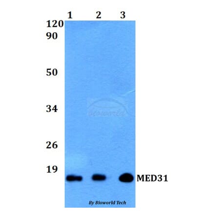 Anti-MED31 Antibody from Bioworld Technology (BS60506) - Antibodies.com