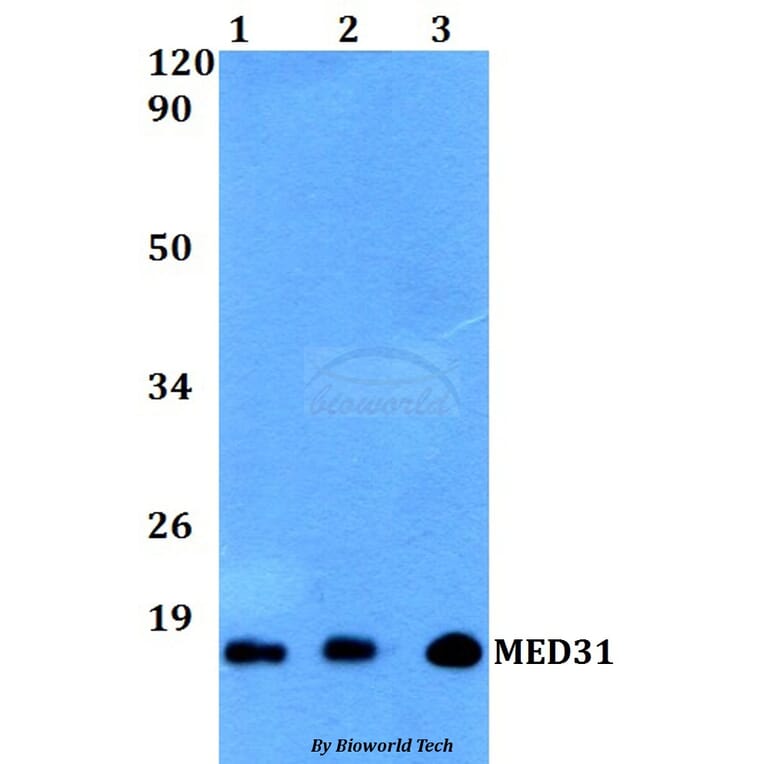 Anti-MED31 Antibody from Bioworld Technology (BS60506) - Antibodies.com