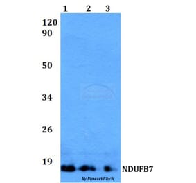 Anti-NDUFB7 Antibody from Bioworld Technology (BS60507) - Antibodies.com