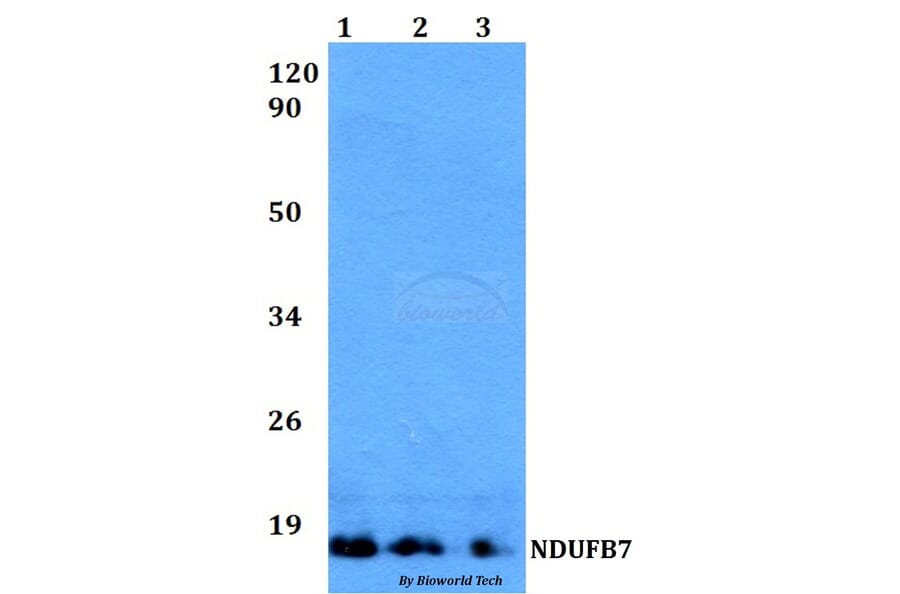 Anti-NDUFB7 Antibody from Bioworld Technology (BS60507) - Antibodies.com
