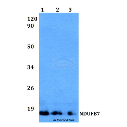 Anti-NDUFB7 Antibody from Bioworld Technology (BS60507) - Antibodies.com