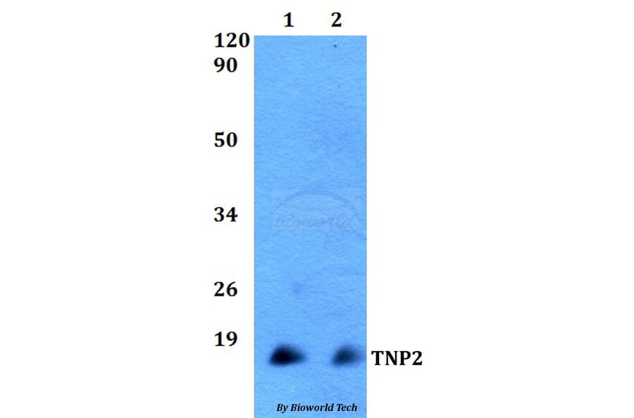 Anti-TNP2 Antibody from Bioworld Technology (BS60508) - Antibodies.com