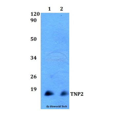 Anti-TNP2 Antibody from Bioworld Technology (BS60508) - Antibodies.com