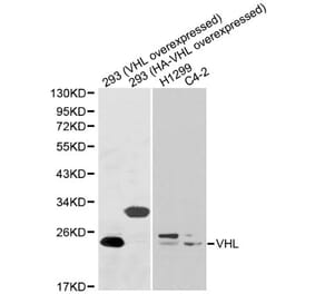 Anti-VHL Antibody from Bioworld Technology (BS6051) - Antibodies.com