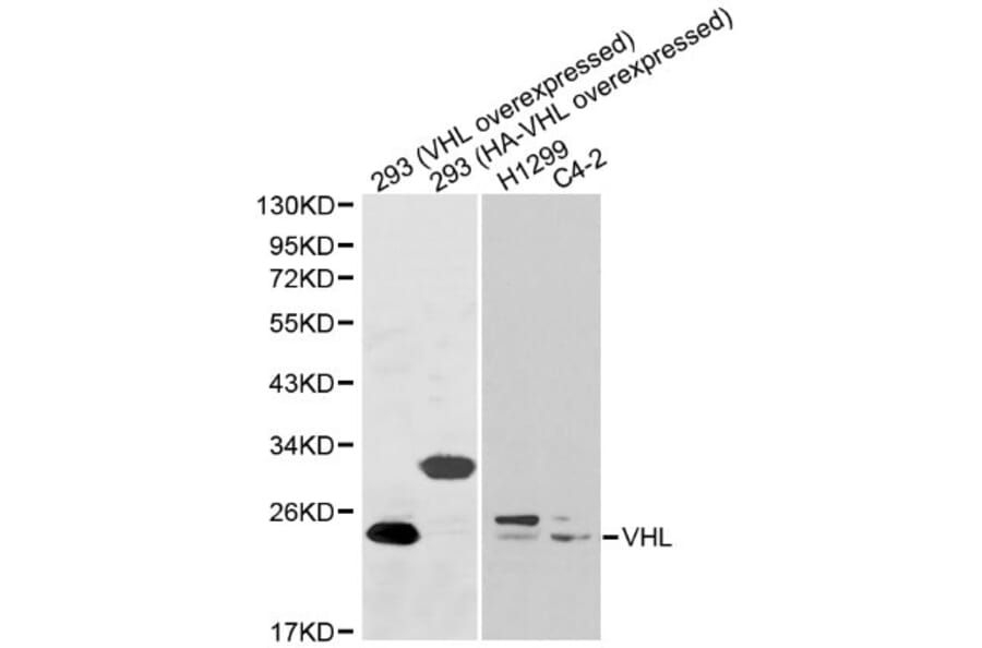 Anti-VHL Antibody from Bioworld Technology (BS6051) - Antibodies.com