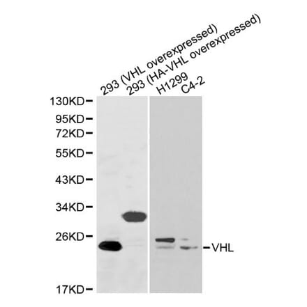 Anti-VHL Antibody from Bioworld Technology (BS6051) - Antibodies.com