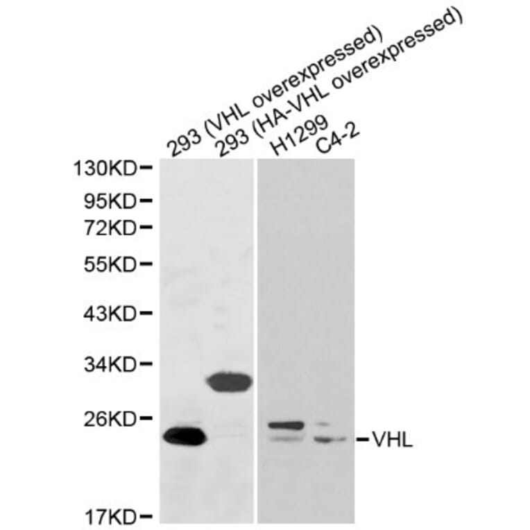 Anti-VHL Antibody from Bioworld Technology (BS6051) - Antibodies.com