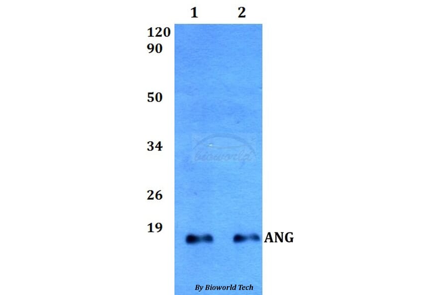 Anti-ANG Antibody from Bioworld Technology (BS60510) - Antibodies.com