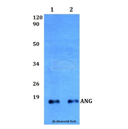 Anti-ANG Antibody from Bioworld Technology (BS60510) - Antibodies.com