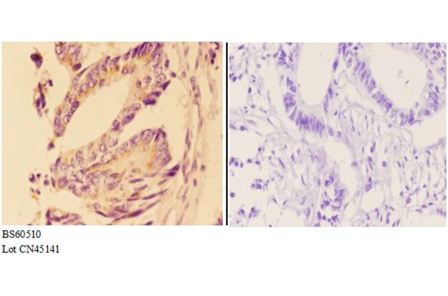 Anti-ANG Antibody from Bioworld Technology (BS60510) - Antibodies.com