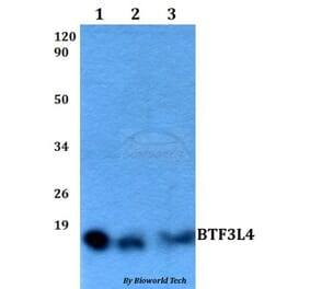 Anti-BTF3L4 Antibody from Bioworld Technology (BS60514) - Antibodies.com