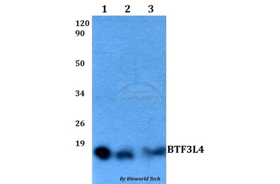 Anti-BTF3L4 Antibody from Bioworld Technology (BS60514) - Antibodies.com