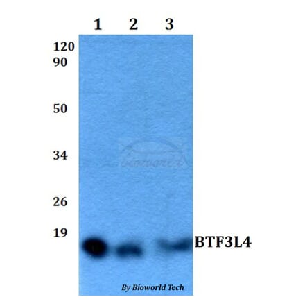 Anti-BTF3L4 Antibody from Bioworld Technology (BS60514) - Antibodies.com