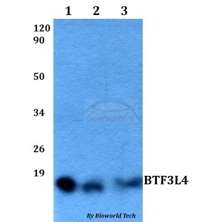 Anti-BTF3L4 Antibody from Bioworld Technology (BS60514) - Antibodies.com
