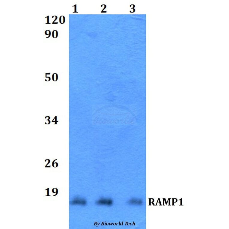 Anti-RAMP1 Antibody from Bioworld Technology (BS60515) - Antibodies.com