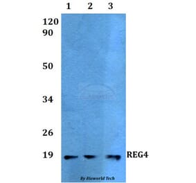 Anti-REG4 Antibody from Bioworld Technology (BS60517) - Antibodies.com