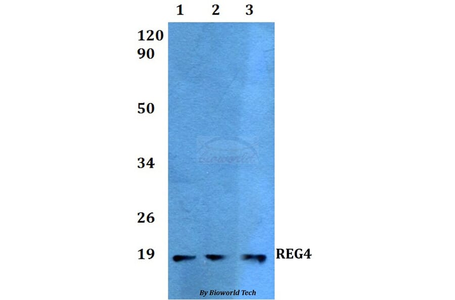 Anti-REG4 Antibody from Bioworld Technology (BS60517) - Antibodies.com