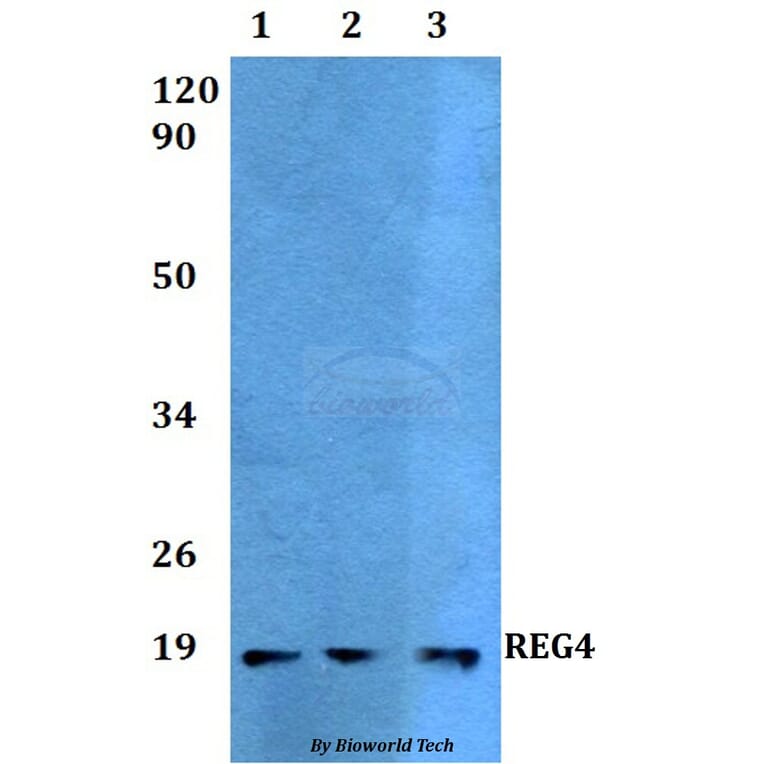 Anti-REG4 Antibody from Bioworld Technology (BS60517) - Antibodies.com