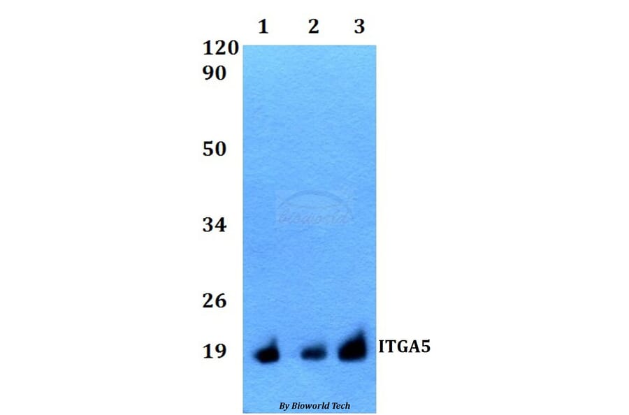 Anti-ITGA5 Antibody from Bioworld Technology (BS60518) - Antibodies.com