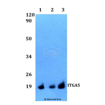 Anti-ITGA5 Antibody from Bioworld Technology (BS60518) - Antibodies.com